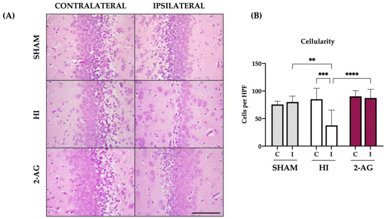 2-AG-treated animals show higher cellularity in the DG of the hippocampus at P14. (A) Representative microphotographs of the DG of the hippocampus from sham, non-treated HI, and 2-AG-treated animals. Images were taken at 40× magnification (Scale bar: 100 μm) (B) Sham animals showed no significant differences in cellularity of the DG from contralateral and ipsilateral hemispheres. On the contrary, the ipsilateral DG of the HI group showed reduced cellularity compared to the contralateral one (*** p < 0.001). Cellularity of the DG in 2-AG-treated animals did not show any significant differences. When comparing ipsilateral DGs of the three groups, significant differences were found between sham and HI animals (** p < 0.01) and also between non-treated HI animals and the ones who received 2-AG treatment (**** p < 0.0001).
