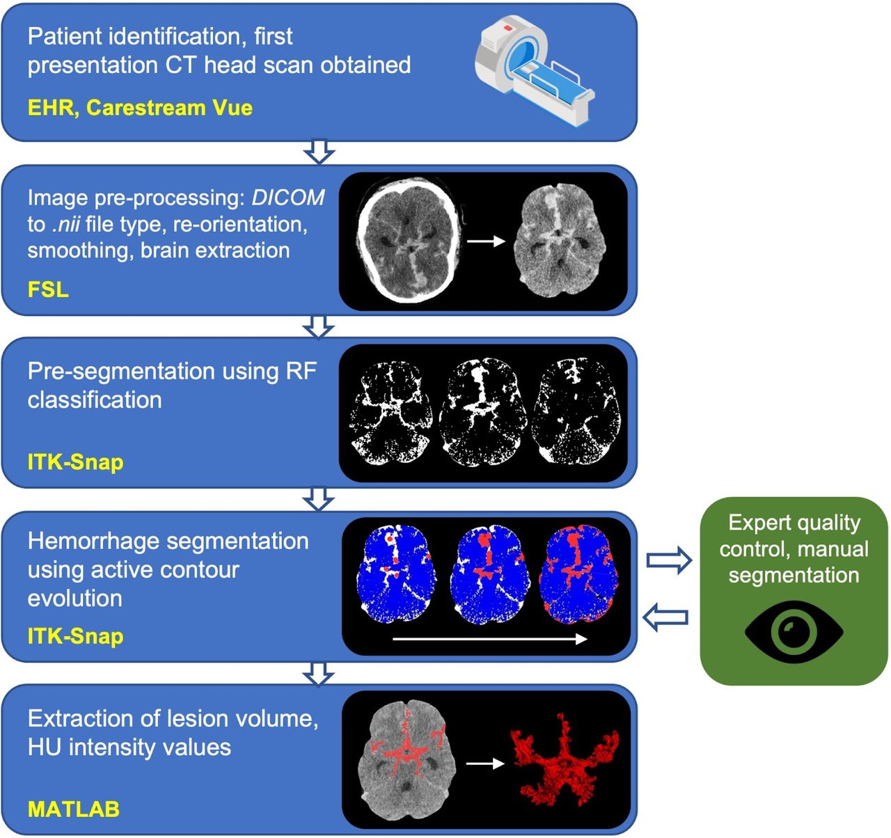 Image processing pipeline describing data collection, pre-processing, segmentation, quality control and information extraction.(yellow font = software library; DICOM = Digital Imaging and Communications in Medicine; nii = nifti file type; FSL = FMRIB Software Library; ITK-Snap = Insight Segmentation and Registration Toolkit; RF = random forest; HU = Hounsfield Units. ‘CT-scan’ designed using resources from Flatiron.com)