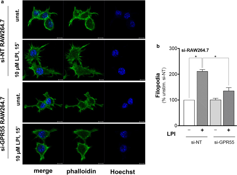LPI induces filopodium appearance through endogenous GPR55 in RAW264.7 cells. RAW264.7 cells interfered with non-targeting (si-NT) or Gpr55-specific (si-GPR55) siRNAs were serum deprived for 2 h, stimulated without or with 10 µM soybean LPI for 15 min, fixed and stained for confocal imaging. Phalloidin staining allows visualisation of filamentous actin, while Hoechst staining reveals cell nuclei (see “Materials and methods” section for details). a Representative confocal images of actin staining, as indicated. Scale bars, 5 µm. b Quantification of filopodium formation, as described in “Materials and methods” section. Data are expressed as proportions (%) of the unstimulated si-NT, as means (± SEM) of three independent experiments, each carried out in duplicate. *p < 0.05 versus LPI-stimulated si-NT (one-way ANOVA, followed by Tukey test)