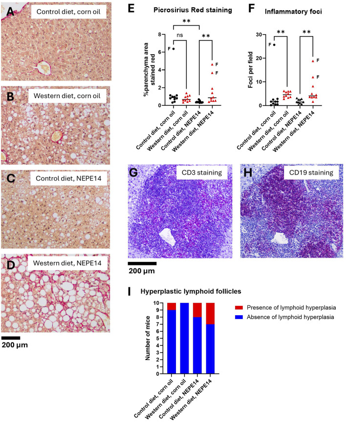 The Western diet promotes liver inflammation. Examples of liver sections stained with picrosirius red from each of the four treatment groups (A–D). The sample in (D) was taken from one of the mice with a stiff, fibrotic liver. (E) Quantification of parenchymal PSR stained area. (F) Counting of inflammatory foci from H&E stained liver sections. In panels E and F, the horizontal lines indicate medians. The data points indicated by letter “F” are from stiff, fibrotic livers. ns: not significant. **: P < 0.01 for post-hoc comparisons after Kruskal-Wallis test with Dunn’s test. (G,H) An example of immunohistochemistry of a hyperplastic lymphoid follicle from a mouse fed the control diet and exposed to NEPE14 with the red-purple color demonstrating the occurrence of both CD3e-positive (G) and CD19-positive cells (H). (I) Incidence of mice with hyperplastic lymphoid follicles observed in H&E stained liver sections.