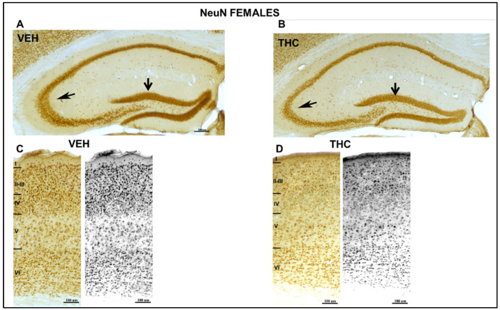 Low microscope magnification photomicrographs of NeuN-immunostained coronal sections of the HIPP and somatosensorial cortex in female mice. Image of NeuN-ir neurons in VEH and THC in female pups (A,B) at PND60 A decrease in CA3 and DG (arrows) layers was observed in THC (B) female mice. Laminar organization of the somatosensorial cortex of the VEH (C) and THC (D) offspring showed aberrant laminar organization of the cortex of THC pups compared with that of VEH mice. Note the increase in density in layer VI and the lower density in layers II–III in THC pups according to the migration pattern of the neocortex, compared with that of the VEH mice —the same scale for (A,B) and (C,D).