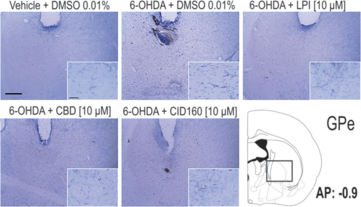 Pallidal cell morphology and verification of the correct placement of the cannula in the nucleus of the GPe. The photomicrographs show the images obtained via the Nissl staining of the GPe and the placement of the cannula in the dorsal area of the GPe. Photomicrographs were taken at 4x and 40x and the scale bar represents 500 and 50 μm, respectively.