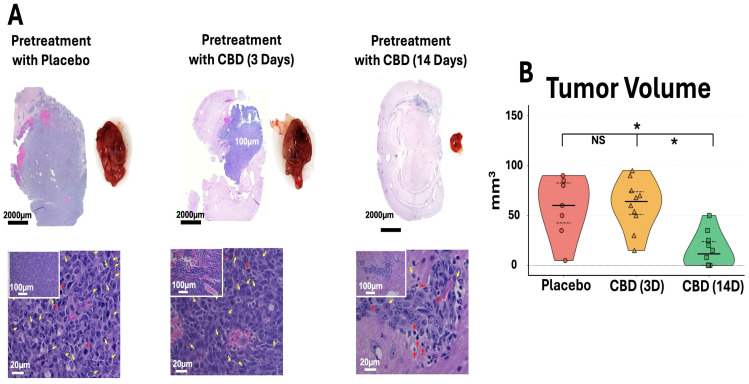 Prophylactic CBD inhalation reduces tumor burden and improves tumor histopathology. (A) Representative H&E sections (scale bars: 2000 μm, 100 μm, 20 μm) and gross tumors show reduced size in 14-day CBD group, with decreased mitotic figures (yellow arrows) and apoptotic cells (red arrows). (B) Ex vivo tumor volume. Violin plots show individual data (symbols), median (center line), and IQR (dashed lines). 14-day CBD significantly reduced volume versus placebo and 3-day CBD (* p < 0.05, NS = not significant). Placebo n = 7 (3 died days 3–5, Figure 2B); CBD groups n = 10 each. One-way ANOVA with Tukey’s test.