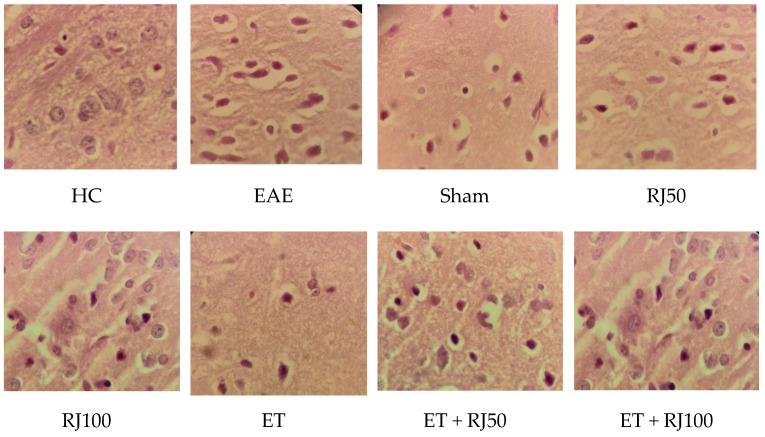 Histopathological analyses of hippocampus. Healthy control (HC); experimental autoimmune encephalomyelitis (EAE); 50 mg/kg royal jelly (RJ50); 100 mg/kg royal jelly J (RJ100); exercise training (ET); exercise training + 50 mg/kg royal jelly (ET + RJ50); exercise training + 100 mg/kg royal jelly (ET + RJ100).