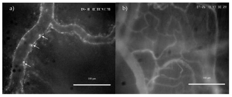 Still frame images from leukocyte trafficking (a) and capillary perfusion (b) videos obtained from intravital microscopy of mouse bladder (magnification = 200×). Rhodamine-6G and FITC were administered i.v into the tail vein to allow fluorescent visualization of leukocyte-endothelial interactions and capillary blood flow, respectively. White arrows indicate leukocytes interacting with the endothelium of the venule.