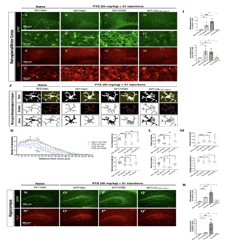 A-D Representative images of co-immunostaining of GFAP and (E-H) Iba1on brain sections from Naïve-WT/Veh (N = 3), PTZ-WT/Veh (N = 3), PTZ-WT/VGB (N = 3), and PTZ-WT/J4 (N = 4) at retrosplenial cortex are shown. A’-D’ Magnified images of the area marked by the rectangle in A-D, respectively. E’-H’ Magnified images of the area marked by the rectangle in E-H, respectively. Arrows indicate the isolated cells that underwent detailed analyses. I Quantitative analysis of percent coverage of GFAP staining (upper panel) and Iba1 staining (lower panel). J Representative single microglia cell underwent the Sholl analysis (upper panel), skeletal analysis (middle panel), and soma assessment (lower panel). K Quantitative results of Sholl analysis showing branching patterns of microglia in indicated groups. **p < 0.01, **** p < 0.0001 PTZ-WT/Veh v.s. Naïve-WT/Veh; # p < 0.05 PTZ-WT/J4 v.s. PTZ-WT/Veh, using two-way ANOVA, with Bonferroni correction as the post-hoc test for multiple comparisons. L Single cell skeletal analysis that quantifies microglial ramification, reflected by the number of branches (upper panel) and junctions (lower panel). M Soma body area and circularity were determined. N-Q Representative images of co-immunostained of brain sections for GFAP and (N’-Q’) Iba1 on hippocampal regions are shown. R Quantitative analyses of percent coverage of GFAP staining (upper panel) and Iba1 staining (lower panel) are shown. Data presented as ± SEM.*p < 0.05, **p < 0.01, ***p < 0.001, ****p < 0.0001, n.s. not significant, using one-way ANOVA, with Bonferroni correction as the post-hoc test for multiple comparisons. Abbreviations: CA1 sr, cornu ammonis 1stratum radiatum; DG mo, dentate gyrus molecular layer