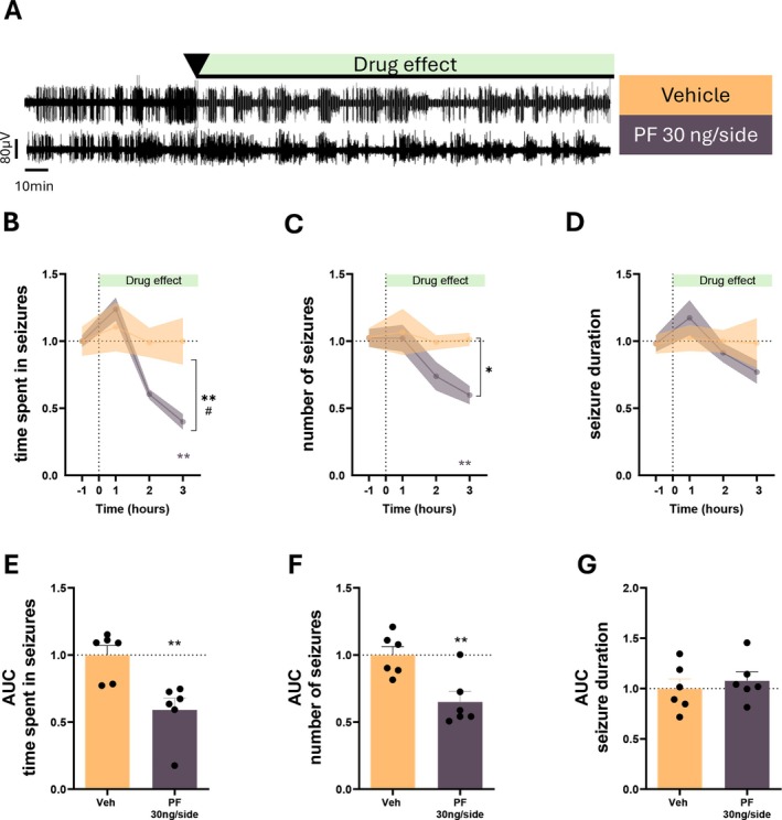 Ventrobasal thalamic FAAH inhibition is sufficient to suppress absence seizures. (A) Representative EEG traces following bilateral vehicle (n = 6) or PF‐04457845 infusion (30 ng/side) (n = 6) into the VB. (B–D) Time course of effects on seizure parameters. PF‐04457845 reduced seizure burden: Time spent in seizures, Treatment F(1,10) = 11.58, p = 0.006 and Time×Treatment F(3,30) = 4.072, p = 0.015; seizure number, Treatment F(1,10) = 6.481, p = 0.029. Reductions occurred during the 1–3 h post‐infusion interval. Seizure duration was not significantly affected. (E–G) AUC analysis confirmed reductions in total seizure time (p = 0.004) and seizure number (p = 0.005), with no effect on seizure duration. Data are mean ± SEM. Two‐way ANOVA with Sidak post hoc tests; one‐way ANOVA with Dunnett post hoc tests. *p < 0.05, **p < 0.01, vs. vehicle.