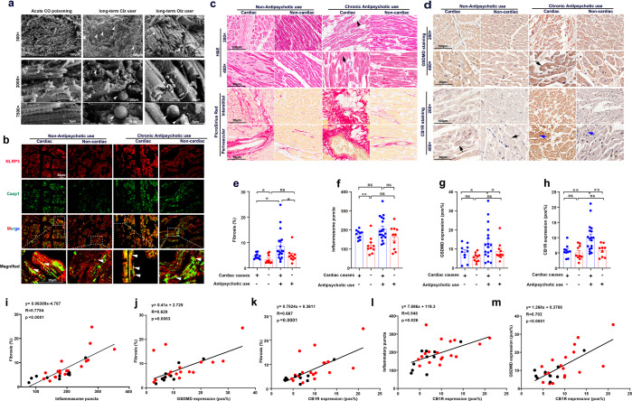 CB1R expression positively correlated with antipsychotics-induced pyroptosis and fibrosis in human specimens. a Scanning electron microscopy of hearts from a control (acute CO poisoning) case and two antipsychotic drug (Clz, Olz) users. Arrowheads indicates bubble-like pyroptotic protrusions. b Immunofluorescence analysis of NLRP3 (red) and Casp1 (green) in the four categories of human heart specimens. Arrowheads indicated NLRP3 inflammasome specks (yellow signal). Scale bar = 20 μm. c H&E staining and PicroSirius red staining of human heart sections. Black arrowhead indicated fatty-fibro tissues and black arrow indicated contraction band necrosis. Magnification = 200× for upper images and 400× for lower images at each staining. d Immunohistochemistry staining of GSDMD and CB1R within the human heart sections. Black arrows indicated membrane-gathering, whereas blue arrows indicated cytoplasm-localization. e–h Quantitative analysis of fibrosis, inflammasome specks, GSDMD expression, and CB1R expression within the heart sections under 400× (n = 18 for antipsychotics users with cardiac deaths, and n = 10 for the other three groups). i–m Linear correlation analysis. Red dots indicated antipsychotics users with cardiac deaths (n = 18) and black dots indicated antipsychotics users with non-cardiac deaths (n = 10). All quantification represents the mean and SEM of each group. Two-way ANOVA with Bonferroni post-hoc test was used for analysis in (e–h). ns, no significance. *p < 0.05; **p < 0.01 as indicated