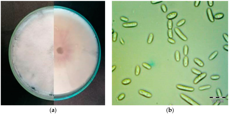 (a) 12-day-old colony of F. oxysporum on Potato Dextrose Agar (PDA) plate (90 mm), front and back; (b) microconidia of F. oxysporum.