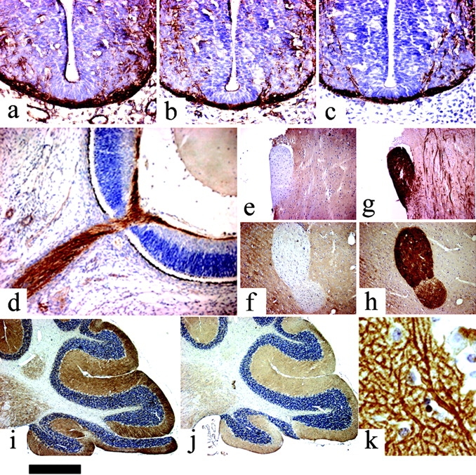 Expression of the novel lipases in the mouse nervous system. DAGLα (a) and DAGβ (b) are expressed in neurofilament-positive axonal tracts (c) in the embryonic spinal cord (day 10). DAGLβ is expressed in the embryonic retinal ganglion fiber layer and optic nerve at day 14 (d). Note the lack of expression of DAGLα in the optic (e) and anterior commissures (f) in the adult. This contrasts with strong staining for the CB1 receptor in these tracts (g and h). DAGLα (i) and DAGLβ (j) expression in the adult cerebellum is restricted to the deep cerebellar nuclei and synaptic fields, including the Purkinje cell dendrites (k). Bar: (a–c) ∼130 μm; (d) ∼220 μm; (e–j) ∼500 μm; (k) ∼20 μm.