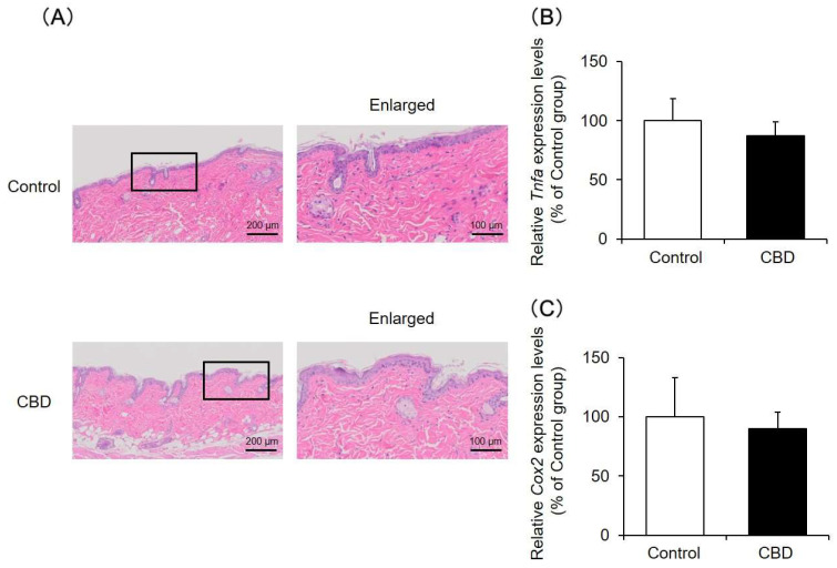 Skin tissue findings and inflammatory reactions. A 1% CBD solution was applied to the back skin of mice for 14 days. After the treatment, the skin was removed, and the tissue was assessed by HE staining (A). The mRNA expression levels of Tnfa (B) and Cox2 (C) in the skin were analyzed by real-time RT-PCR (n = 6, means ± SD).