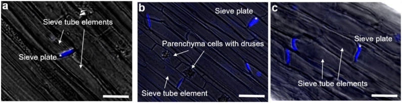 Callose localization at the sieve plates revealed using aniline blue. (a) Top, (b) middle and (c) bottom internode of the stem. The sieve tube elements and phloem parenchyma cells containing crystal druses are indicated with white arrows; sieve plates are indicated with an asterisk. Bars: 10 µm.