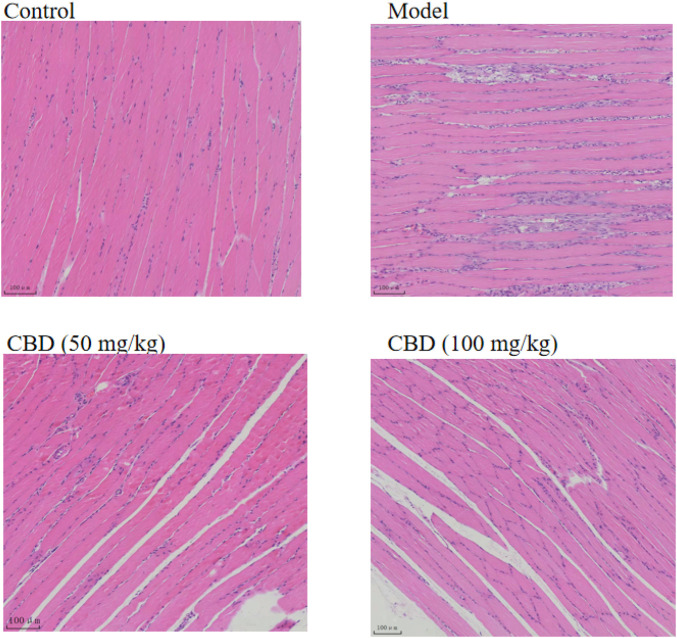 Effects of CBD on histopathology in the experimental rats. The skeletal muscle tissues were stained with H&E, and micrographs were taken at 100× magnification.