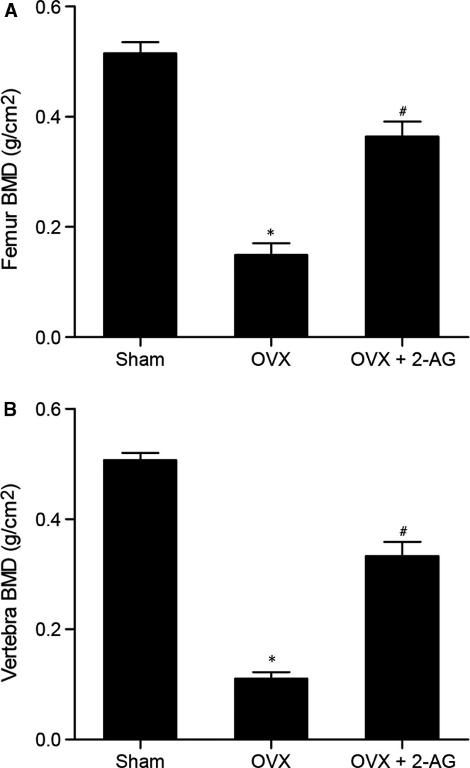 2‐AG treatment improved BMD in OVX mice, and increased BMD in femur (A) and vertebra (B) in OVX mice (*P value < .05 vs sham group; #P value <.05 vs OVX group; OVX: ovariectomy)