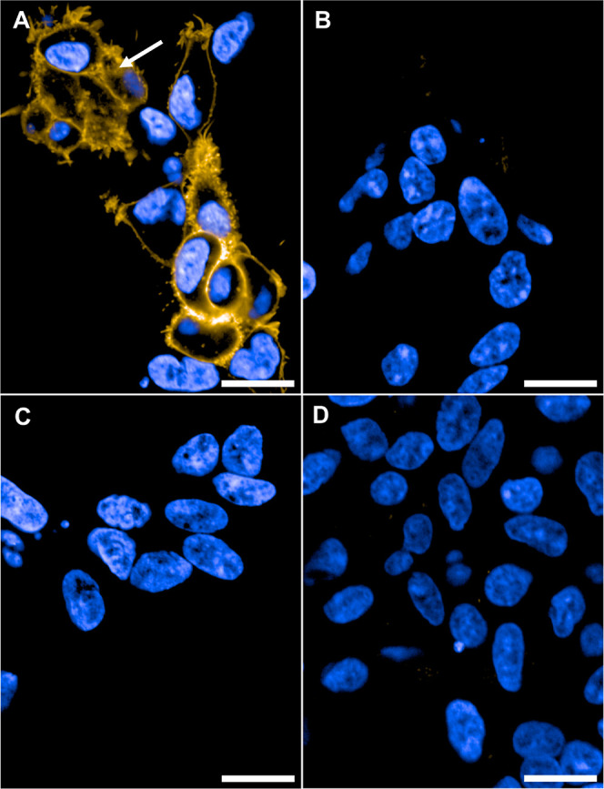 Live cell confocal imaging of HEK293TR cells. (A) Induced CB1R-HEK293TR cells incubated with 29 (250 nM, yellow). White arrow: Intracellular staining by 29. (B) Induced CB2R-HEK293TR cells incubated with 29 (250 nM, yellow). (C) Uninduced CB1R-HEK293TR cells incubated with 29 (250 nM, yellow). (D) Induced CB1R-HEK293TR cells preincubated with competitor 6 (5 μM, 30 min) and then 29 (250 nM, yellow). Images recorded after 10 min at 63× magnification with nucleus counter stain Hoechst 33342 (blue). Scale bars 20 μm images are representative of two to three independent experiments.