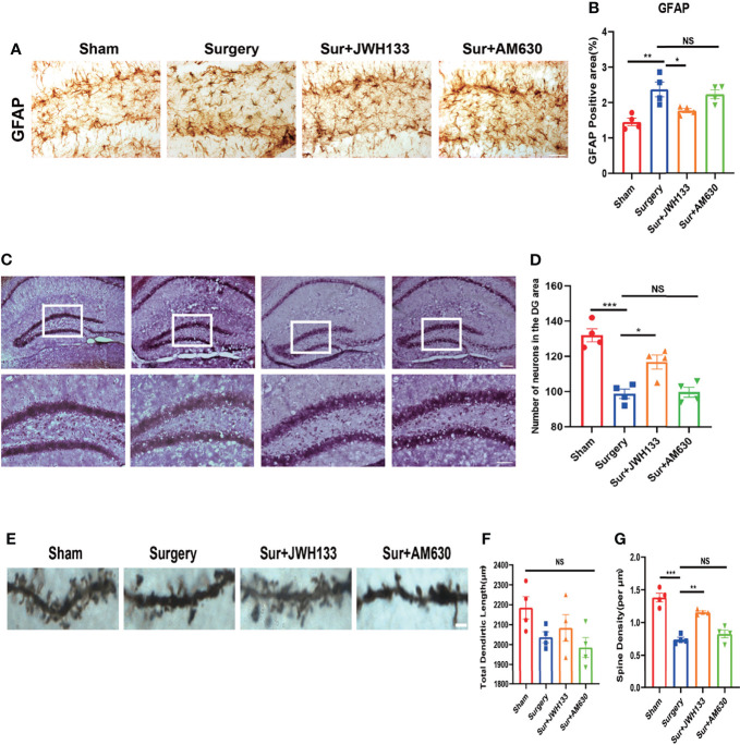 (A, B) GFAP expression analyzed by immunochemistry in the hippocampal dentate gyrus brain region; statistical data depicted in the graph (means±SEM, n=4, scale bars=100 μm). Quantification of positive areas by using ImageJ. (C, D) Nissl staining of the hippocampus in (C) and statistical graph is shown in (D) (n=4, scale bars =200 μm and 100μm). Examination of the hippocampus by Golgi–Cox staining (E–G); pictures analyzed with the NeuroJ plugin in ImageJ to calculate the total length of dendrites and the density of synaptic spines (means±SEM, n=4, scale bars=4 μm). NS means not significant, *P < 0.05, **P < 0.01, ***P < 0.001 compared with the corresponding group, as determined by ANOVA.