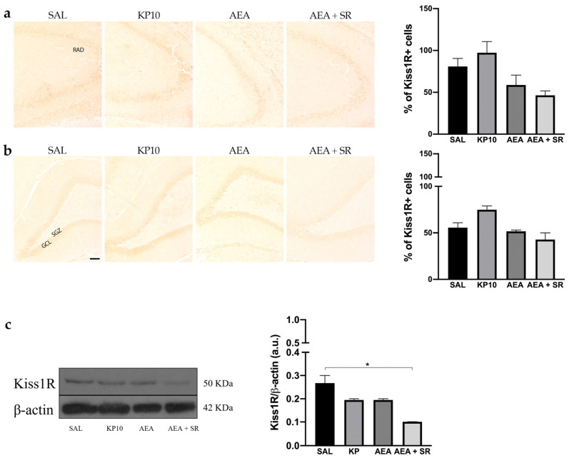 Expression and distribution of Kiss1R in hippocampus. Representative images showing IHC staining in rat CA3 (a) and DG (b) for Kiss1R expression (brown) of control (SAL), kisspeptin (KP10), anandamide (AEA), and AEA plus SR141716-treated animals (AEA + SR). RAD, stratum radiatum; SGZ, subgranular zone; GCL, granule cell layer (n = 4 for each group). Scale bar = 100 μm. Histograms below the images show the percentage of Kiss1R-positive compared to controls. (c) Representative immunoblot of kiss1R expression in controls and treated animals. β-actin was used as a loading control (n = 3 for each group). Data are expressed as mean ± SEM. * p < 0.05.