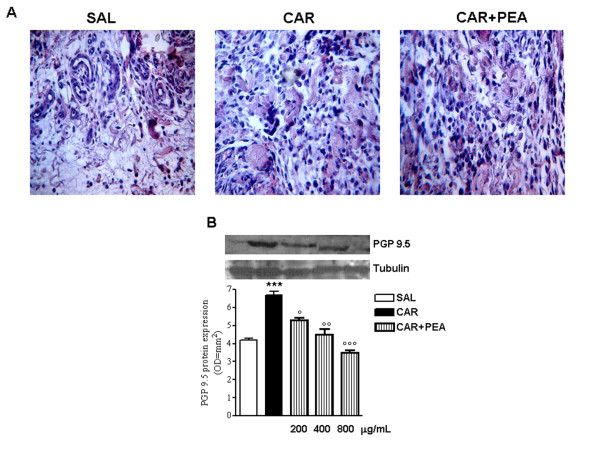 Effect of PEA on λ-carrageenin-induced neurogenesis. (A) Nerves formation was evaluated in representative histological analysis of granulomatous tissue stained with hematoxyl and eosin. Fields are representative of 3 separate experiments. Original magnification, 100×. (B) Representative Western blot analysis and relative densitometric analysis of PGP 9.5 protein expression, as a marker of neuronal cells. Results are expressed as mean ± SEM of 3 experiments. *p < 0.05, **p < 0.01, ***p < 0.001 vs. saline; °p < 0.05, °°p < 0.01, °°°p < 0.001 vs. λ-carrageenin alone.