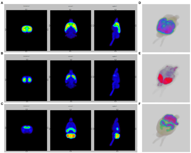 SPECT brain images obtained by Monte Carlo simulations, using the WHS SD Rat Brain V 2.0 phantom. (A) Slice images of the activated striatum and cerebral cortex for the opioid system; (B) Slice images of the activated striatum for the dopaminergic system; (C) Slice images of the activated thalamus, cerebellum and globus pallidus for the endocannabinoid system; (D–F) 3D SPECT reconstructions.