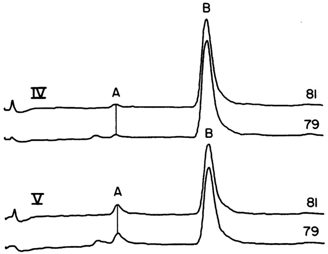 Extracted ion profiles for APCI-MS chromatograms of bromine isotopes at m/z 79 and 81 to show the exposure of children to the flame-retardant Tris-BP through urinalysis of the metabolite 2,3-dobromopropanol (Peak A) after their pajamas had been laundered for ∼5 months. Peak B is an internal standard. Figure adapted with permission from ref (57). Copyright 1978 The American Association for the Advancement of Science.