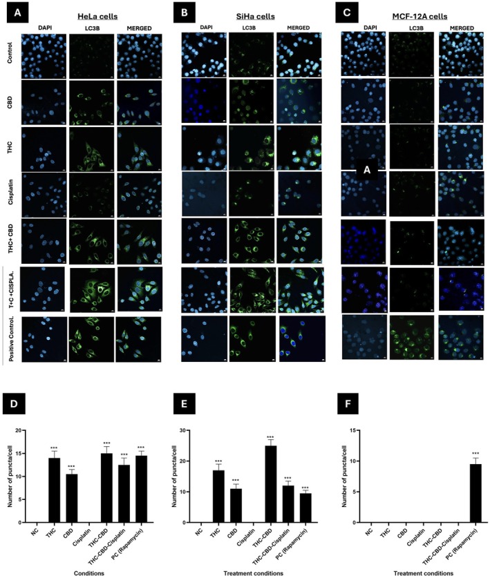 Immunofluorescence analysis of autophagic activity in HeLa, SiHa, and MCF‐12A cells after 72 h of treatment. Representative immunofluorescence images showing autophagic activity in (A) HeLa, (B) SiHa, and (C) MCF‐12A cells after 72 h of treatment. Cells were stained for LC3B (green), an indicator of autophagy, and the nuclei were counterstained with DAPI (blue). Bar graphs (D–F) represent the quantification of LC3B puncta per cell in HeLa, SiHa and MCF‐12A cells, resprectively. Standard deviation represented by T‐bars; ***p < 0.001. NC, negative control; PC, positive control (Rapamycin, 0.5 μM).
