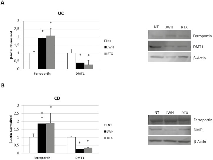 Ferroportin and DMT1 protein expression in OCs from (A) 7 patients with UC and (B) 7 patients with CD after 48 hours of exposure with JWH-133 (100 nM) and RTX (5 μM). Protein levels were determined by Western blot, loading 15 μg of total lysates. The most representative images are displayed. The protein bands were detected through Image Studio Digits software. The intensity ratios of immunoblots, compared to the NT, taken as 1, were quantified after normalizing with respective controls. The relative quantifications for Ferroportin and DMT1 expression, normalized for the housekeeping protein β-actin, are presented in the histograms as the mean ± SD of independent experiments on each individual sample. A Student t-test was used for statistical analysis. *P ≤ .05 compared to the NT. Abbreviations: CD, Crohn’s disease; DMT1, divalent metal transporter-1; NT, untreated control; OC, osteoclasts; RTX, Resiniferatoxin; SD, standard deviation; UC, ulcerative colitis.