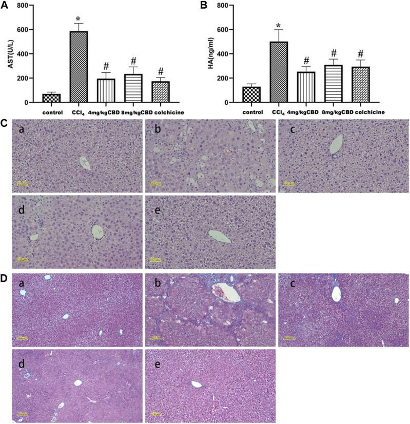 Effects of CBD treatment on liver function in mice with CCl4-induced liver fibrosis. (A,B) Serum AST and HA levels in the indicated groups. (C) Representative HE staining of liver sections. (D) Fibrosis deposition was observed by Masson trichrome staining. The values represent the means ± SEM (n = 8). * p < 0.05 vs. the control group, # p < 0.05 vs. the CCl4 group, as determined by one-way ANOVA, followed by the LSD multiple comparisons test. (a) Control group; (b) CCl4 group; (c) 4 mg/kg CBD group; (d) 8 mg/kg CBD group; (e) 0.2 mg/kg colchicine group.