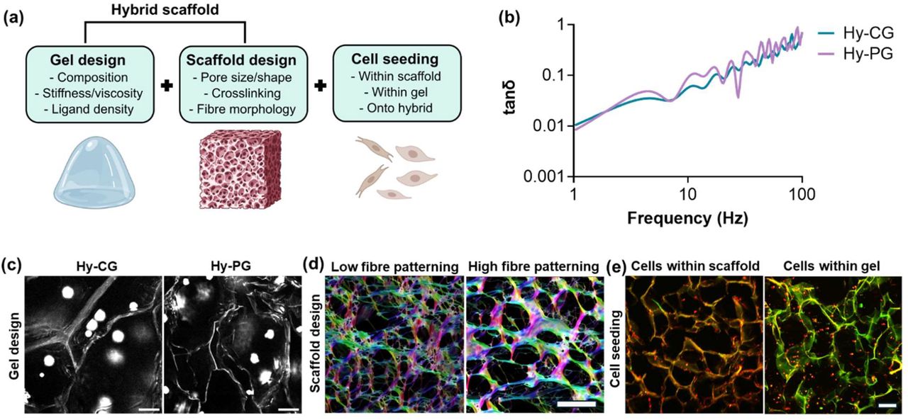 Hybrid biomaterials allow combined control over multiple biophysical properties.(a) Schematic demonstrating degrees of freedom in hybrid scaffold design, incorporating control over collagen scaffold design, gel design, and localisation of seeded cells; (b) Microrheology analysis showing plots of tanδ characteristic of viscoelastic solids for cell-free hybrid scaffolds containing collagen gel (Hy-CG) or self-assembling peptide gels (Hy-PG); (c) Multiphoton images showing efficient penetration of both collagen and self-assembling peptide gels to produce a hybrid scaffold as shown by encapsulated polystyrene beads, scale bar 50 µm; (d) Scanning electron microscopy images with false colour overlay (colour = orientation, brightness = coherency) showing collagen fibre structural control in scaffold design via change of solute during ice-templating (low fibre patterning = 0.001 M HCl, high fibre patterning = 0.05 M acetic acid), scale 50 µm; (e) Multiphoton images of human dermal fibroblasts in hybrid scaffolds, demonstrating that cells may be successfully seeded into the scaffold or the gel component of the hybrid scaffold, scale bar 200 µm.