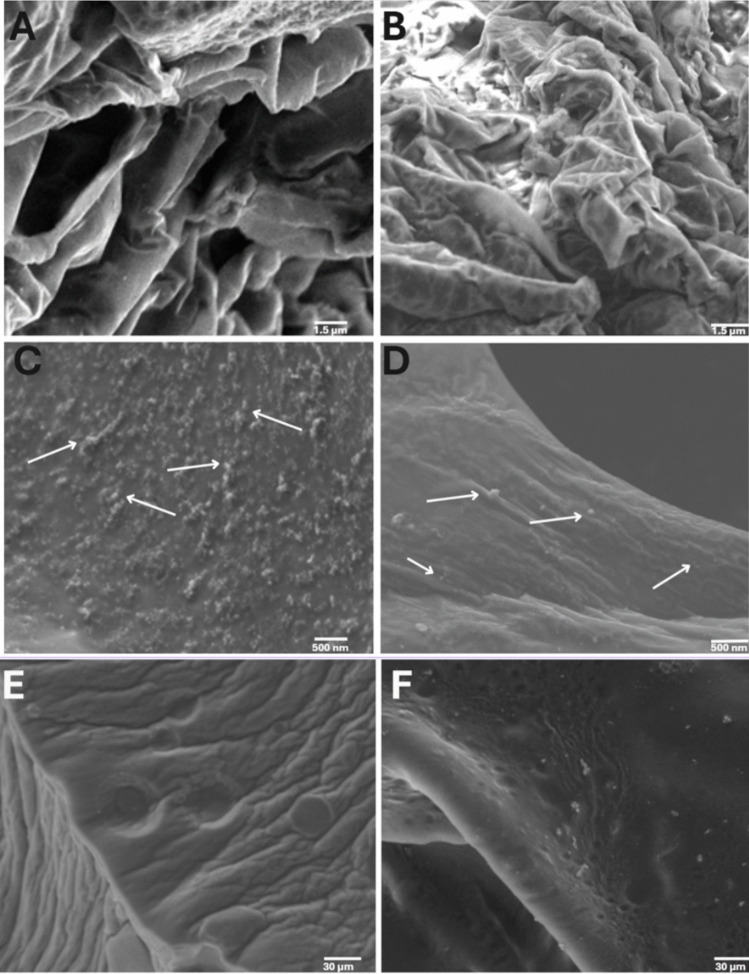 Microstructural characterization of non-loaded and CBD-loaded hHL hydrogels. (A-D) HR-SEM micrographs of (A) non-loaded 1:25, (B) non-loaded 1:30, (C) CBD-loaded 1:25 and (D) CBD-loaded 1:30 hydrogels. (E,F) E-SEM micrographs of (E) non-loaded and (F) CBD-loaded 1:25 hydrogels. Arrows point out nanostructures consistent with CBD-loaded polymeric micelles.