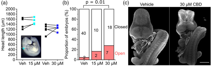 CBD impairs cranial neural tube closure. (a) Quantification of head length as indicated by the vertical white line in the inset (cyan circle shows the otic pit). Points represent the mean of 3–4 embryos per condition and lines connect paired points from the same litter. Neither comparison between vehicle and CBD treatments were significantly different. (b) Quantification of the proportion of embryos with >17 somites at the end of culture which had open or closed cranial neuropores. The number of embryos in each group is indicated. (c) Representative confocal images showing a vehicle‐treated embryo with closed cranial NT and a CBD‐treated littermate with exencephaly. Scale bar = 500 μm. CBD, Cannabidiol