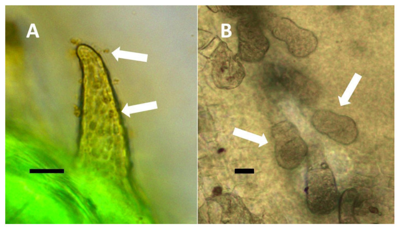 Leaf trichomes of Solanum dulcamara. (A) Developing pitted filamentous trichome stained with potassium permanganate to show ethylene (brown color) around bacteria (arrows) emerging from and within pits of trichome (arrow) (Bar = 10 µm). (B) Glandular trichomes (arrows) along leaf veins stained with acidified diphenylamine to show nitrate (blue-purple color) in hairs (Bar = 10 µm).