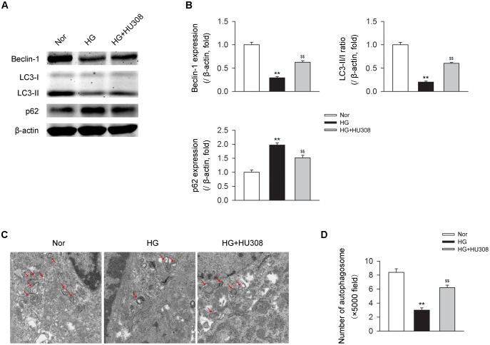 Administration of HU308 enhances cardiac autophagy in cardiomyocytes under the challenge of HG. Primary murine ventricular cardiomyocytes were obtained from neonatal C57BL/6J mice and challenged with high glucose concentration (HG; 33 mM glucose) for 24 h as hyperglycemia group or medium with normal glucose concentration (Nor; 5.5 mM glucose) as the control group. In certain groups, HU308 (10 μM) was treated to cells at 10 min before suffering HG. PBS in the same volume was administrated as vehicle. (A) Representative images of the autophagy-related proteins including beclin-1, LC3-II/I, and p62. (B) Quantitative analysis of the autophagy-related proteins (n = 5). ∗∗P < 0.01 vs. Nor group; $$P < 0.01 vs. HG group. (C) Representative images of transmission electron microscopy with arrows marking autophagosomes. (D) Quantitative analysis of the number of autophagosomes in murine ventricular cardiomyocytes (n = 5). ∗∗P < 0.01 vs. Nor group; $$P < 0.01 vs. HG group. Nor, normal; DCM, diabetic cardiomyopathy.