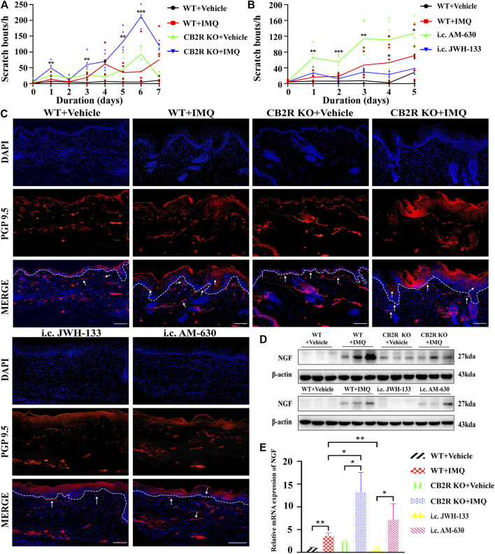 Effects of CB2R on the scratching behavior and expression of nerve fibers in IMQ-induced PsD. (A, B) The behavior results of mice in different groups. ( C) PGP 9.5 stained (red fluorescence) nerve fibers in the skin biopsies from mice, co-stained with DAPI (blue fluorescence) to detect the nucleus. Scale bar represents 100 μm. (D) Protein level of NGF was analyzed by western blotting in the six groups of mice. β-actin served as the loading control. ( E) The mRNA expression levels of NGF was measured by qRT-PCR. Error bars represent mean ± SD. (n = 5 for each group). *p < 0.05, **p < 0.01, and ***p < 0.001 when compared. All the assays were repeated three times with consistent results.