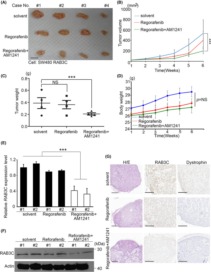 Synergistic effect of regorafenib and CB2 agonists in vivo. (A) Overview of solid tumor response to regorafenib alone or regorafenib combined with AM1241 compared with control group in vivo. Scale bar: 1 cm. (B) Tumor growth curve of solvent control, regorafenib alone, and regorafenib combined with AM1241 in vivo. (C) Quantitation of tumor weights in mice with solvent, regorafenib alone, and regorafenib combined with AM1241 treatments (P = 0.019). (D) Bodyweights of mice treated with solvent, regorafenib alone, and regorafenib combined with AM1241 in vivo. (E) qRT‐PCR analysis of RAB3C in solid tumors of mice treated with solvent, regorafenib alone, and regorafenib combined with AM1241. (F) Western blot analysis of RAB3C protein expression in solid tumors of mice treated with solvent, regorafenib alone, and regorafenib combined with AM1241. We used regorafenib at a concentration of 10 μm in this study, and at a concentration of 1 μm for AM1241. (G) Representative images of dystrophin/RAB3C protein staining and H/E staining results in xenograft models. We used paired t‐tests to analyze statistical significance in control and regorafenib groups. Scale bar: 500 μm. ***P < 0.001, NS, not significant. Data are presented as the mean ± standard error of the mean. Student's t‐test was used for the comparison of measurable variants of two groups. All experiments were performed with at least three biological duplicates (n = 3) for each group, in triplicate.
