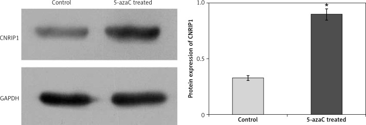 CNRIP1 protein expression levels within colon cancer cell lines treated with 5-azaC. Treatment of SW620 with 5-azaC resulted in a significantly increased (p < 0.05) level of CNRIP1 protein expression (0.900 ±0.05) relative to untreated SW620 cells (0.329 ±0.02)*p < 0.05 (5-azaC treated vs. control).