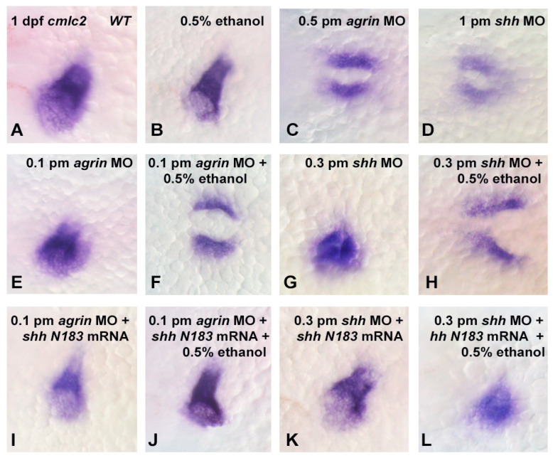 Extracellular matrix signaling involving agrin and Shh is disrupted by ethanol exposure in early cardiac development. Cmlc2 mRNA expression was analyzed in dorsal views of 1 dpf embryos. (A), wild-type; (B), 0.5% ethanol exposure from 3–24 hpf; (C), 0.5 pmol agrin MO injection of embryos; (D), 1 pmol shh MO injection of embryos; (E), sub-threshold 0.1 pmol agrin MO injection; (F), 0.1 pmol agrin MO combined with 0.5% ethanol exposure; (G), sub-threshold 0.3 pmol shh MO injection; (H), 0.3 pmol shh MO combined with 0.5% ethanol; (I), 0.1 pmol agrin MO and 25 pg shhN183 mRNA injection of embryos; (J), 25 pg shhN183 mRNA injection rescues the cmlc2 expression pattern in embryos treated with 0.1 pmol agrin MO and 0.5% ethanol; (K), 0.3 pmol shh MO and 25 pg shhN183 mRNA injection of embryos; (L), 25 pg shhN183 mRNA injection rescues cmlc2 expression pattern in embryos treated with 0.3 pmol shh MO and 0.5% ethanol.