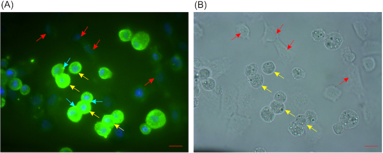 Detection of apolipophorin III in G. mellonella hemocytes. Hemocytes collected from non-immunized larvae were fixed on a slide and incubated with primary anti-apoLp-III and secondary FITC-labeled antibodies. Green fluorescence corresponds to the apoLp-III localization in the cells. Hemocyte nuclei were stained with Hoechst 32 258 (blue fluorescence). Images were taken using a laser scanning confocal microscope at a wavelength λ = 495/517 nm (A) and in transmitted light (B). Red arrows—plasmatocytes, yellow arrows—granulocytes, blue arrows—apoLp-III localization. Magnification 100×. Scale–10 µm.