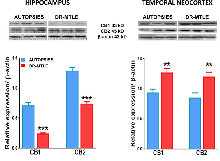 CB1 and CB2 protein expression in human microvessels obtained from non-epileptic autopsies and patients with DR-MTLE. Upper panels: Representative Western blots of CB1 and CB2 receptor proteins in microvessels isolated from the hippocampus and temporal neocortex of non-epileptic autopsies and patients with DR-MTLE. Lower panels: Representation of the densitometric analysis. The results are expressed as a percentage of the optical density (O.D.) ratio of CB1 and CB2-immunostained bands to those of β-actin. Data are presented as mean ± standard error. **p < 0.01, ***p < 0.001.