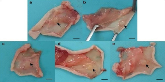 Gross appearance of tumors in mice subcutaneously injected with 1 × 107 MCF-7 cells. (a) Negative control, gavaged with sesame oil; (b) positive control, treated with 5-fluorouracil (5-FU, 20 mg/kg, intraperitoneally, three times per week); (c) THC:CBD (1:6) low-dose group, gavaged at 2 mg/kg BW; (d) THC:CBD (1:6) intermediate-dose group, gavaged at 10 mg/kg BW; (e) THC:CBD (1:6) high-dose group, gavaged at 20 mg/kg BW. Scale bar = 0.5 cm. Tumors appeared as small, firm, well-circumscribed nodules at the injection sites (arrows). 5-FU = 5-fluorouracil, THC: CBD = tetrahydrocannabinol:cannabidiol.
