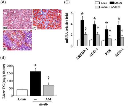 Effects of AM251 on lipid droplet accumulation and lipogenesis‐regulated factors in the liver tissues of the db/db mice. A, Liver tissues were embedded in an OCT medium and stained with Oil‐Red O reagent. The conditions were listed as (a) Lean control mice, (b) db/db mice, and (c) db/db mice treated with 5 mg/kg AM251. The results are shown at ×200 magnification. B, Liver TG levels were detected using colorimetric assay. C, The mRNA levels of lipogenesis‐regulated factors were measured using quantitative real‐time polymerase chain reaction. *P < .05 vs Lean control mice (n = 7); † P < .05 vs db/db mice (n = 8). ACC‐1, acetyl‐CoA carboxylase‐1; FAS, fatty acid synthase; mRNA, messenger RNA; OCT, optimal cutting temperature; SCD‐1, stearoyl‐CoA desaturase‐1; SREBP‐1, sterol regulatory element‐binding factor‐1; TG, triglycerides