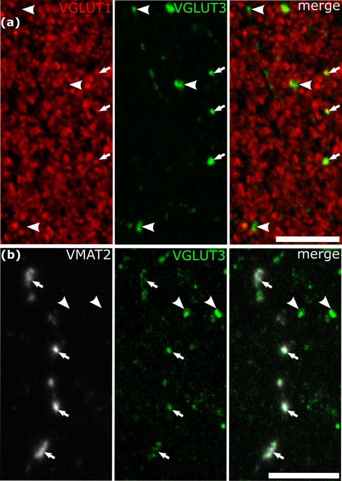 Co‐expression of VGLUT3 with VGLUT1 or VMAT2 in some cortical axonal varicosities. (a) A high density of VGLUT1‐positive terminals include infrequent VGLUT3‐positive boutons (arrows), but other VGLUT3‐positive boutons are immunonegative for VGLUT1 (e.g. arrowheads) in layer 3. (Patient S, left middle temporal gyrus). (b) Some of the large VGLUT3‐positive boutons (green, arrows) are positive for VMAT2, but other boutons are immunonegative for VMAT2 (e.g. arrowhead) (Patient S, left middle temporal gyrus). Maximum intensity projection of optical slices with total Z‐stack depth of 2.6 μm (a) and 8.5 μm (b). Scale bars: 10 μm.