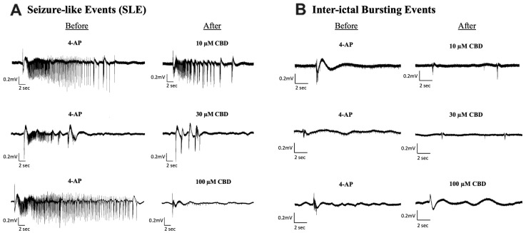 Sample traces of seizure-like events and inter-ictal bursting events before and after the addition of Cannabidiol (CBD). Example of electrophysiological recordings of (A) seizure-like events (SLE) and (B) inter-ictal bursting events before (left column) and after (right column) the addition of 10 µM, 30 µM, and 100 µM CBD in 3 separate slice experiments.