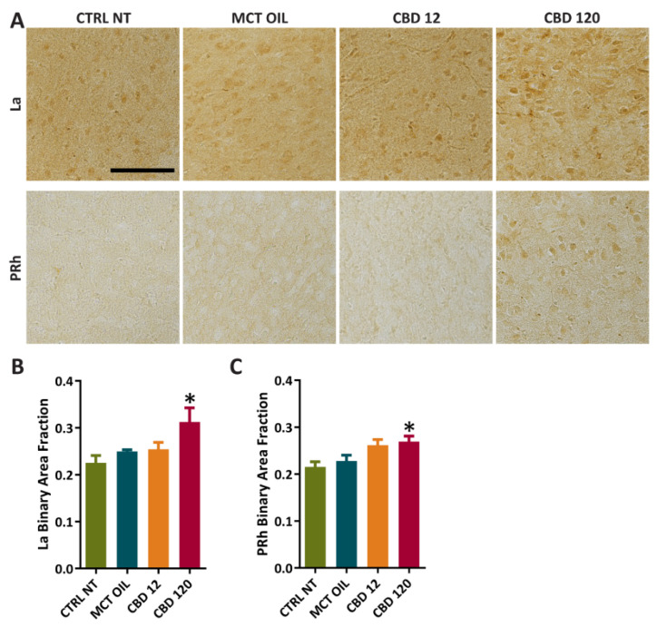 PPARγ immunoreactivity in extrahippocampal regions of controls and rats treated with cannabidiol (CBD) or with medium-chain triglyceride (MCT) oil. Non-treated controls (CTRL NT, n = 6) and epileptic animals (A) treated with CBD at high dose (CBD 120, n = 6), CBD at low dose (CBD 12, n = 6), or MCT oil (MCT OIL, n = 6) were used to determine the levels of PPARγ in lateral amygdala (La) (B), and perirhinal cortex (PRh) (C). * p < 0.05, CBD 120 vs. CTRL NT; Holm-Šidák test. Scale: 0.1 mm.