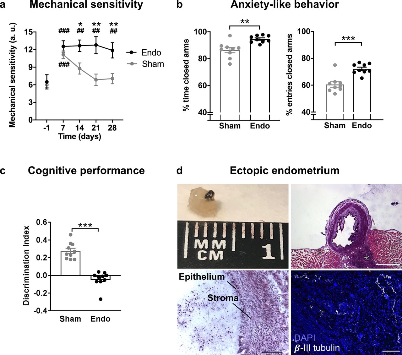 Behavioral and histological alterations in female mice with ectopic endometrial implants.Endometriosis mice showed (a) persistent increase in pelvic mechanical sensitivity (b) increased anxiety-like behavior and (c) cognitive impairment. (d) Cysts recovered from endometriosis mice were filled of fluid, contained endometrial epithelium and stroma and were innervated by beta-III tubulin-labeled fibers. Blue is DAPI and white is β-III tubulin. Scale bar = 1 mm (upper right), 100 μm (lower left and lower right). Error bars are mean ± SEM. One-way repeated measures ANOVA + Bonferroni (a) and Student t-test (b and c). *p<0.05, **p<0.01, ***p<0.001 vs sham. ##p<0.01, ###p<0.001 vs baseline. Endo, endometriosis; a.u., arbitrary units. Figure 1 - figure supplements 1 and 2. Figure 1 - Source Data.