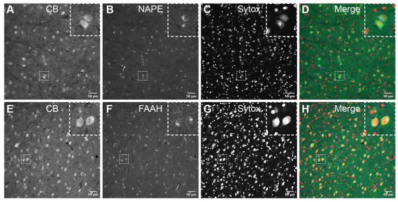 Double-label immunofluorescence illustrating the co-localization of eCB-synthesizing—NAPE-PLD (A–D, insets)—and degrading—FAAH (E–H, insets)—enzymes with calbindin in the somatodendritic compartment of PI neurons. The dashed squares in panels A–H indicate representative cells displayed at a higher magnification in the respective insets (3 × digital zoom). Nuclear counterstaining with Sytox orange is shown in the third column of each panel. CB: calbindin-D28k; FAAH: fatty acid amide hydrolase; NAPE-PLD: N-acyl phosphatidylethanolamine phospholipase D. Scale bar = 50 µm.