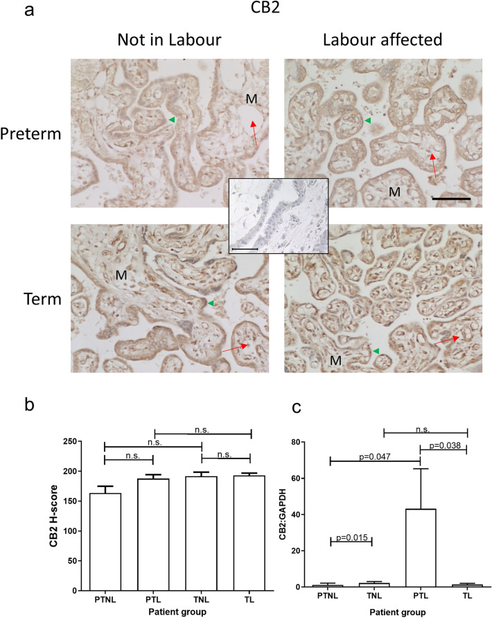 Effect of labour and prematurity on CB2 protein and transcript expression and levels. Representative photomicrographs of villous trophoblasts from ten images taken for each patient within each of the four patient groups (n = 6 samples per group) are shown in panel a. Images were obtained at 200× and 40× magnification as described in the legend to Fig. 2. Bar, 50 μm. Panel b shows the results of histomorphometric analyses of the 240 CB2 immunoreactivity images for the four different patient groups. Differences between groups were calculated using one-way ANOVA; n.s. non-significant. Panel c shows the levels of CB2 mRNA corrected for the levels of GAPDH. Data are presented as the mean ± SEM of six patient samples in each group, with each sample examined in triplicate. Differences in expression levels were determined using one-way ANOVA with Dunnett’s T3 multiple comparisons tests; p-values are shown for significant comparisons