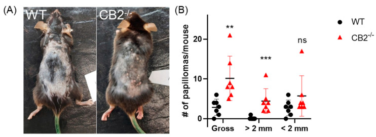CB2 receptor protects against papilloma development in DMBA/TPA model. (A) Representative image of papillomas on the backs of WT and CB2-/- males after 27 weeks of cancer induction. (B) Gross number of papillomas, papillomas less than 2 mm and greater than 2 mm. Mann–Whitney U test, ** p < 0.01, *** p < 0.001, ns, not significant.