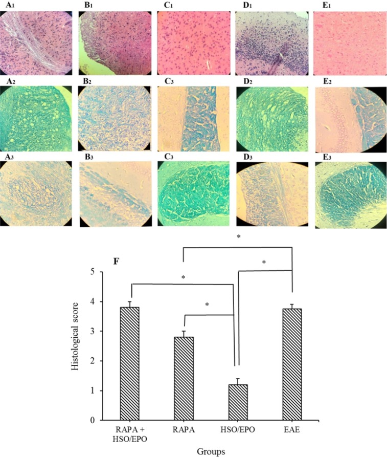 Pathological analysis of brain sections. Group A, RAPA + HSO/EPO-treated mice showed (A1) a large number of inflammatory cells, strings of the non-myelin axon, neuronophagia, (A2) vacuolation, spongy lesions, and (A3) extensive demyelination; group B, rapamycin-treated mice showed (B1) infiltration of inflammatory cells, (B2) spongiotic zones, and (B3) demyelination; group C, HSO/EPO-treated mice showed (C1), a few inflammatory cells and (C2,3) without spongy lesions and demyelination; group D, EAE mice showed (D1) extensive focal inflammatory cells, (D2) extensive vacuolation, zones of spongy degeneration, and (D3) demyelination; group E1-3, the section of the brain of naive mice exhibited no clinical signs. The first row was stained with H&E, the second and third rows were stained with LFB; F, histological score: 0 = no pathology, 1 = no tissue damage but minor inflammation, 2 = modest inflammation, prime tissue damage and demyelination, 3 = moderate tissue damage (demyelination, neuronal loss, tissue damage, cell death, neuronal vacuolation, and neuronophagia), 4 = necrosis (loss of all tissue elements entirely with associated cellular remains). Data presented as mean ± SEM. *P value ≤ 0.05 is significant. EAE, experimental autoimmune encephalomyelitis; HSO/EPO, hemp seed oil/evening primrose oil; RAPA, rapamycin; H&E, hematoxylin and eosin; LFB, luxol fast blue.