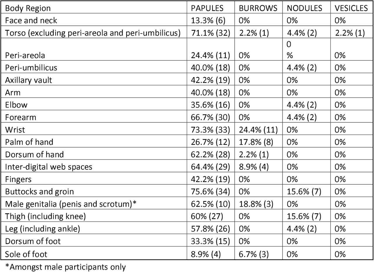 Proportion of individuals with scabies with lesions in different body regions (n=45)