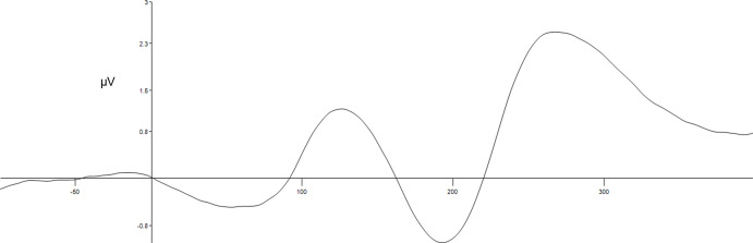 Variation of ERP across time from 100 ms before to 400 ms after the onset of S2 in the Gold bar-lemon task. The waveform shown is an average of signals recorded from P7, P3, Pz, P4, and P8. The P300 peaks at about 270 ms.